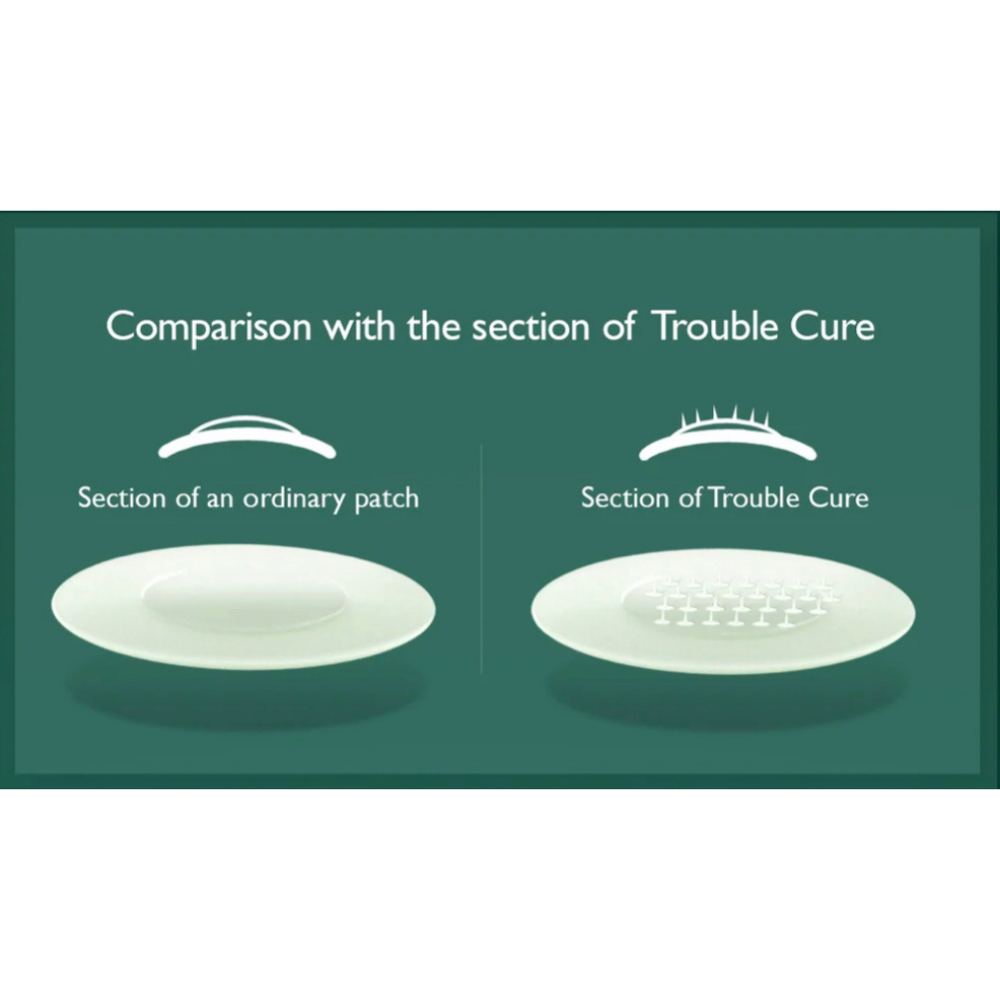 ACROPASS Trouble Cure Pimple Patches (2 types)